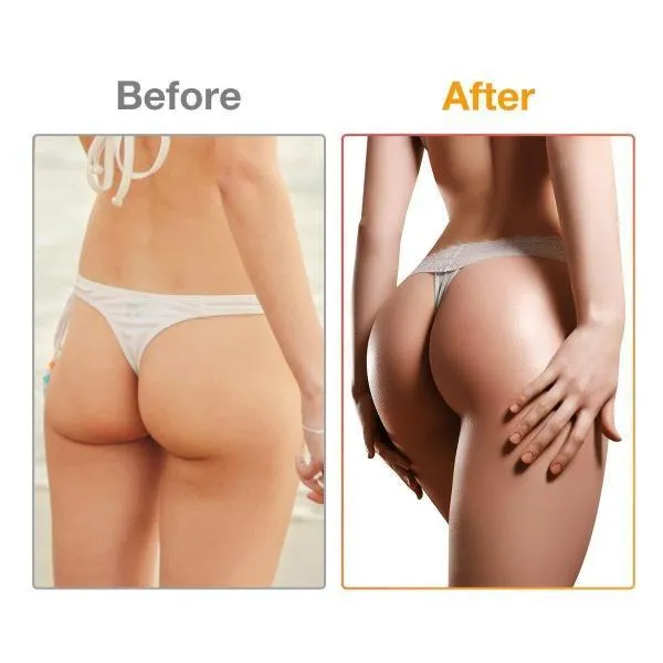 Wireless Hip & Buttocks Stimulator With Remote Control